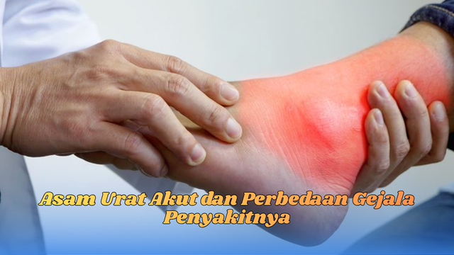 asam urat akut