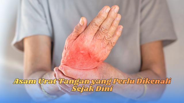 asam urat tangan
