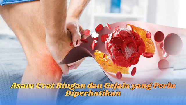 Asam Urat Ringan dan Gejala yang Perlu Diperhatikan